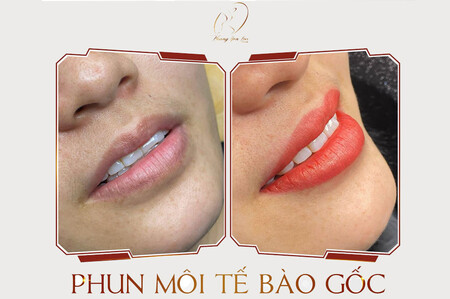 dich-vu-phun-moi-te-bao-goc