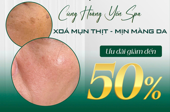 dich-vu-xoa-mun-thit