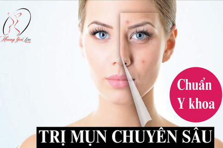 tri-mun